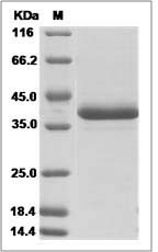 Human DEFA3 Protein (Fc Tag) SDS-PAGE