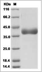 Rat Cathepsin B / CTSB Protein (His Tag)