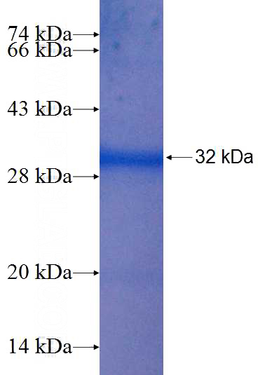 Recombinant Human CYP39A1 SDS-PAGE