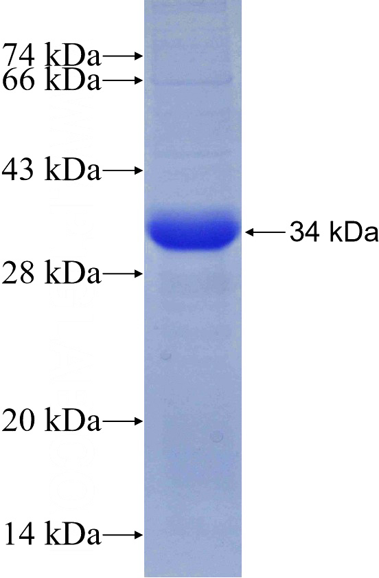 Recombinant Human NR3C2 SDS-PAGE