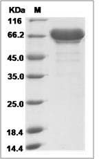 Ebola virus EBOV (subtype Sudan, strain Gulu) VP40 / Matrix protein VP40 Protein (His & MBP Tag)