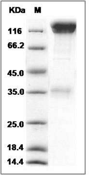 Mouse CD45 / PTPRC Protein (Fc Tag) SDS-PAGE