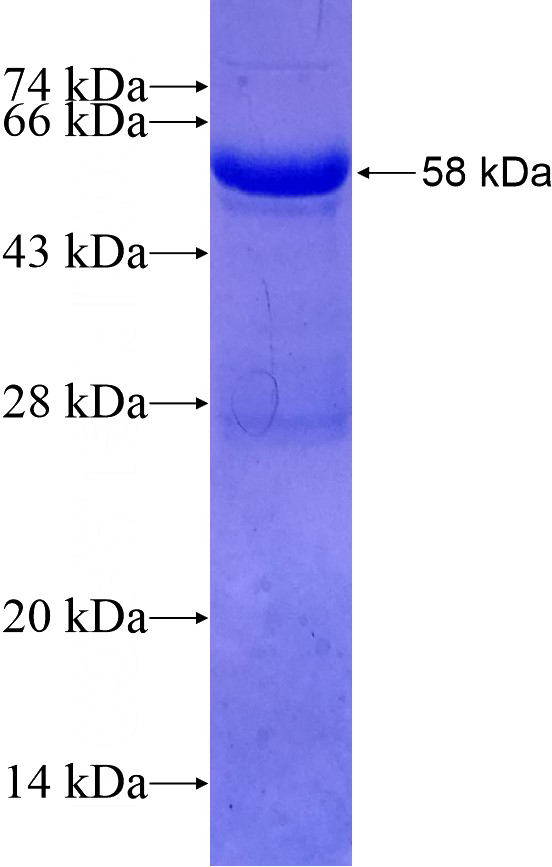 Recombinant Human STAP2 SDS-PAGE