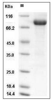 Mouse DDR1 Kinase / MCK10 / CD167 Protein (Fc Tag) SDS-PAGE