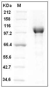 Human PARP-1 / PARP Protein (His Tag) SDS-PAGE