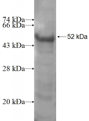 Recombinant Human SNIP1 SDS-PAGE