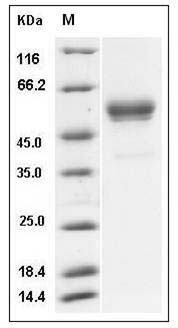 Mouse IFNG / Interferon Gamma Protein (Fc Tag) SDS-PAGE