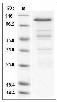 Human PRMT3 Protein (GST Tag) SDS-PAGE