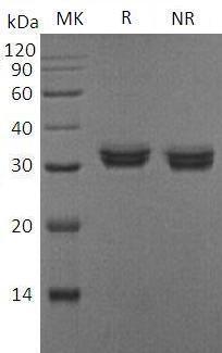 Human IL10RA/IL10R (His tag) recombinant protein