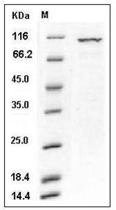 Human PKC iota / PRKCI Protein (GST Tag) SDS-PAGE