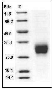 Rat CD16a / FCGR3A Protein (His Tag) SDS-PAGE