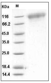 Mouse TrkC / NTRK3 Protein (His Tag) SDS-PAGE