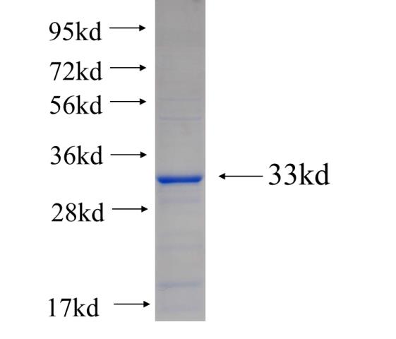 Recombinant human FAM181A SDS-PAGE
