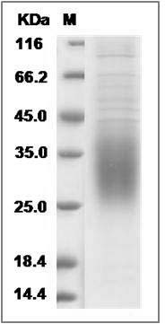 Rat CD47 Protein (His Tag) SDS-PAGE