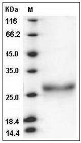 Rat Erythropoietin / EPO Protein (His Tag) SDS-PAGE