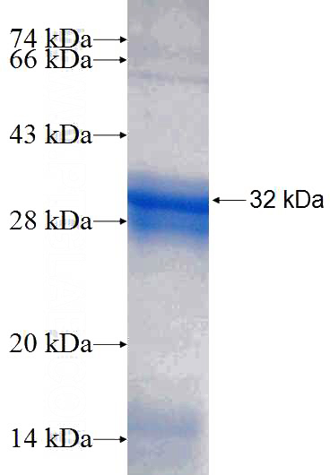 Recombinant Human METTL6 SDS-PAGE
