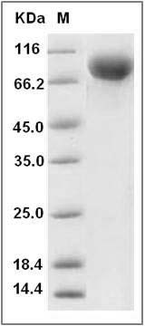 Human IL2RG / CD132 Protein (Fc Tag) SDS-PAGE