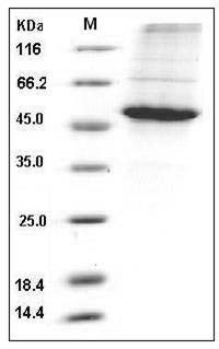 Human CCNE1 / Cyclin-E1 Protein (His Tag) SDS-PAGE