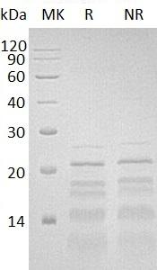 Human PHLDA2/BWR1C/HLDA2/IPL/TSSC3 (His tag) recombinant protein