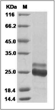 Human K-Ras / K-Ras (12 Cys) Protein (His Tag) SDS-PAGE