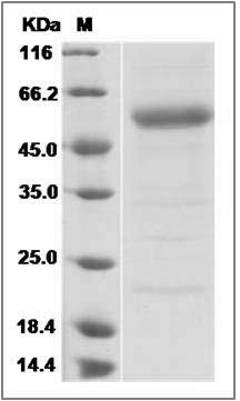 Human PRELP Protein SDS-PAGE