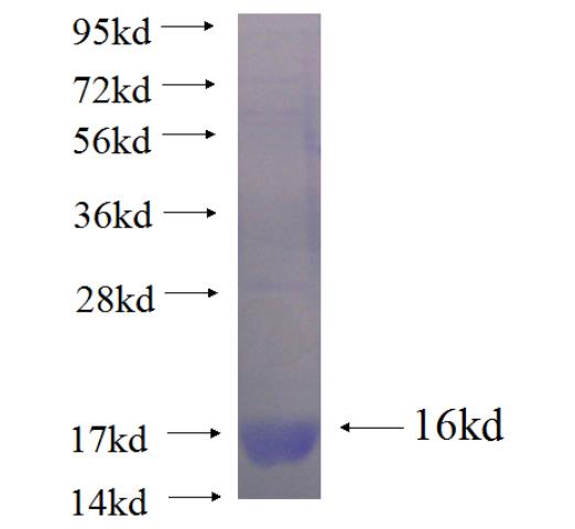 Recombinant human NKX6-2 SDS-PAGE