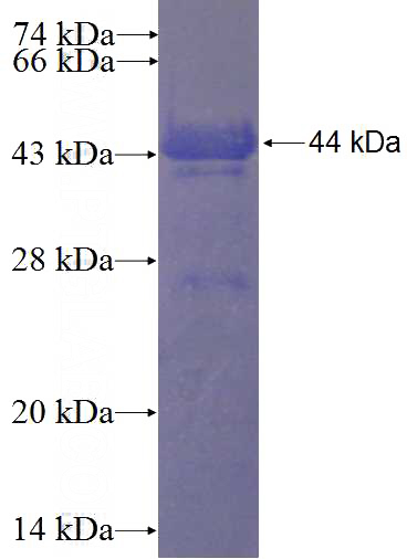Recombinant Human CENTD3 SDS-PAGE