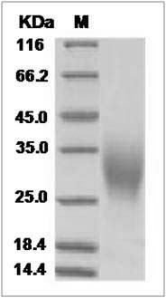 Human GM-CSF / CSF2 Protein SDS-PAGE