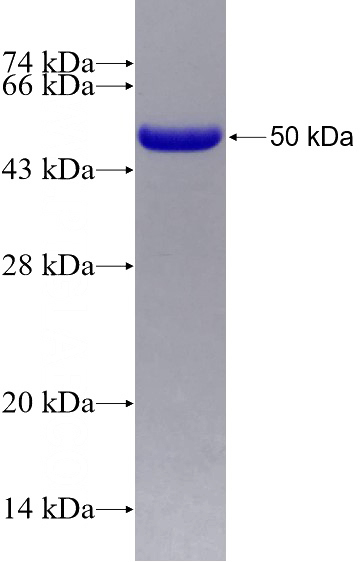 Human SMARCA2-Specific Recombinant protein (6*His tag)