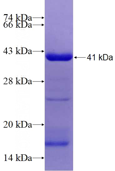 Recombinant Human SCN5A SDS-PAGE