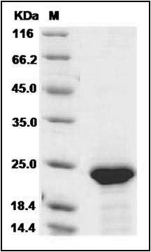 Human FGF21 Protein (His Tag) SDS-PAGE