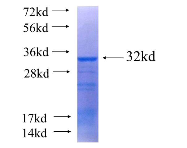 Recombinant human NKX3-1(Full length) SDS-PAGE
