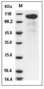 Rat HER2 / ErbB2 Protein SDS-PAGE