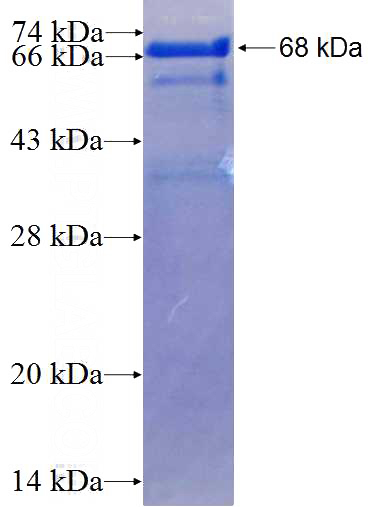 Recombinant Human KDM5C SDS-PAGE