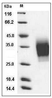Human PTH1R / PTHR1 / PTH1 Receptor Protein (His Tag) SDS-PAGE