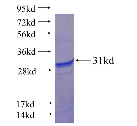 Recombinant human C10orf27 SDS-PAGE