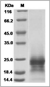 Human PRAP1 / Proline-rich acidic protein 1 Protein (His Tag) SDS-PAGE