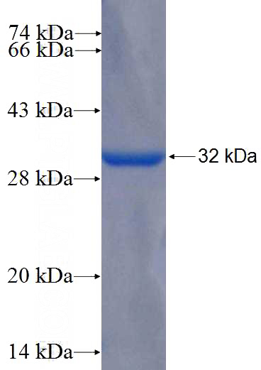Human FGF9 Recombinant protein (GST tag)