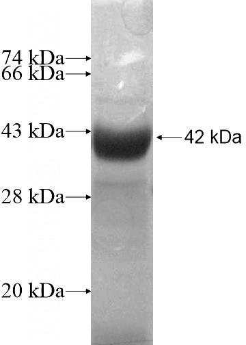 Recombinant Human GALNT14 SDS-PAGE