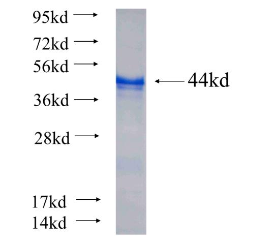 Recombinant human MPHOSPH8 SDS-PAGE