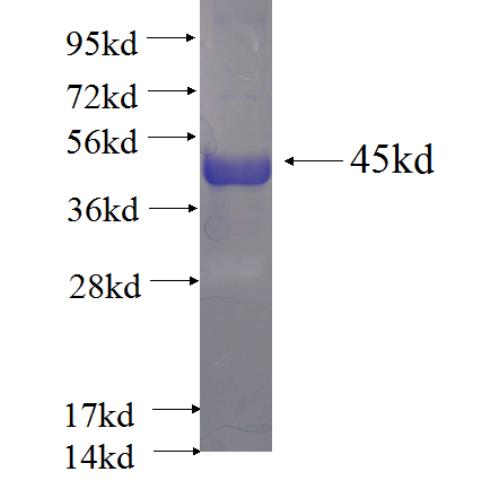 Recombinant Arabidopsis thaliana ATHDA15 SDS-PAGE