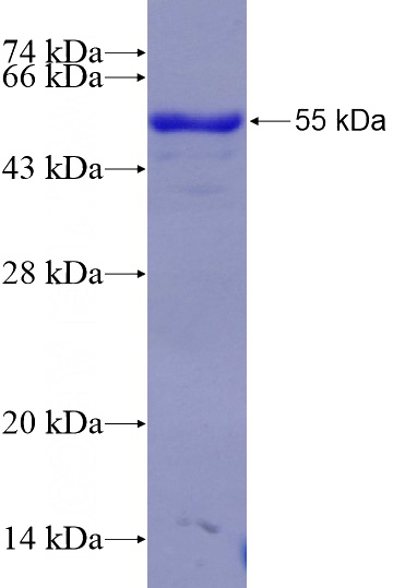 Recombinant Human FAM83G SDS-PAGE