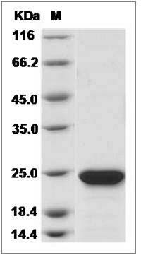 Cynomolgus RBP4 Protein (His Tag) SDS-PAGE