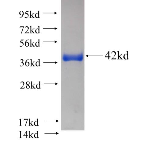 Recombinant human DNAJC16 SDS-PAGE