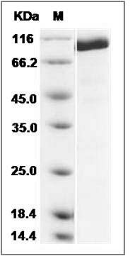 Mouse CD45 / PTPRC Protein (aa 453-1152) SDS-PAGE