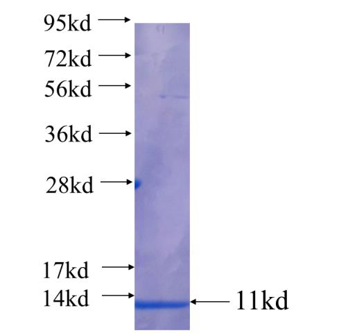 Recombinant human COL4A5 SDS-PAGE