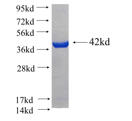 Recombinant human TTC7A SDS-PAGE