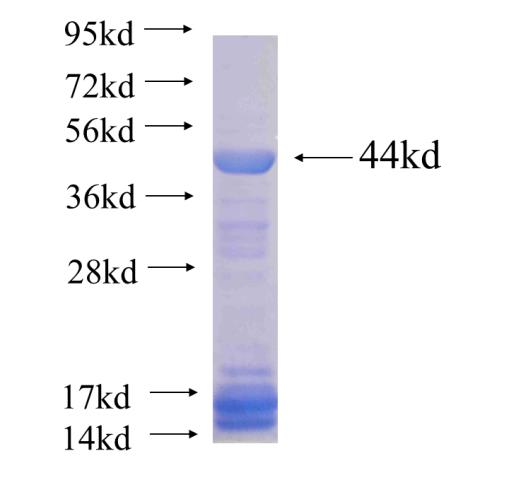 Recombinant human SPG11 SDS-PAGE