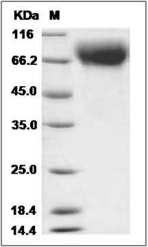Canine TrkB / NTRK2 Protein (His Tag) SDS-PAGE