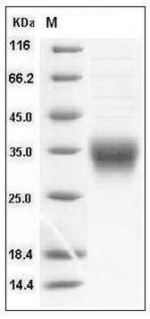 Mouse CD8a / Lyt2 Protein (His Tag) SDS-PAGE